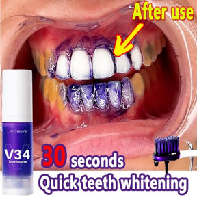 Whitening Toothpaste