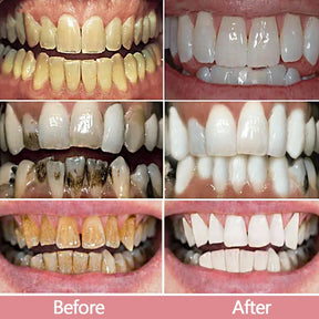 Whitening Toothpaste